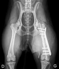 FEMUR POSTOP 238.jpg