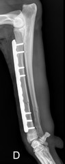 Fracture Radius Post Op RADIUS POSTOP 238.jpg