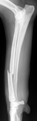 Fracture Radius Pré Op RADIUS PREOP 238.jpg