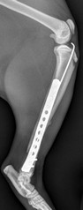 TIBIA POSTOP P S0 I0 238.jpg